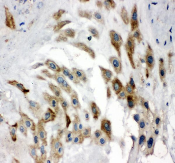 Anti-Noggin Antibody