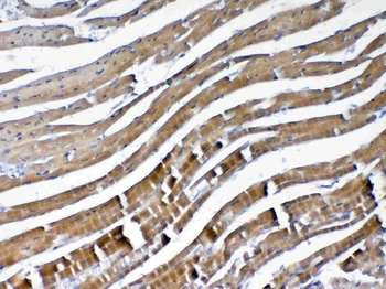 Anti-VEGFB Antibody