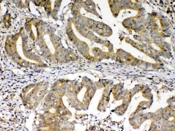 Anti-FZD3 Antibody