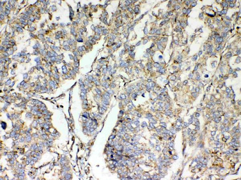 Anti-TSPAN12 Antibody