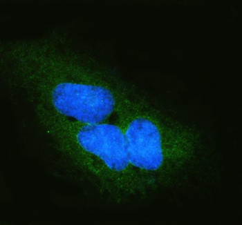 Anti-DYNLT1 Antibody