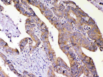 Anti-AMD1 Antibody