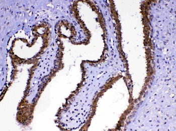 Anti-MED4 Antibody