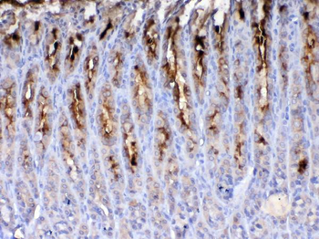 Anti-TFF2 Antibody