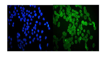 Anti-Hsp20/HSPB6 Antibody