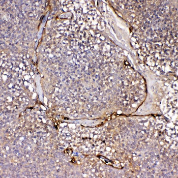 Anti-IL1F10 Antibody