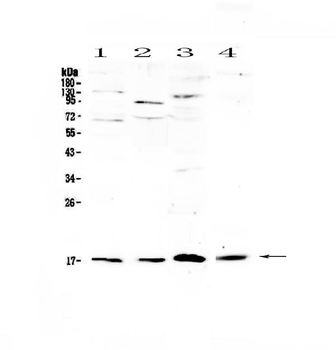 Anti-IL1F10 Antibody