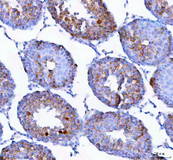 Anti-Epigen/Epgn Antibody