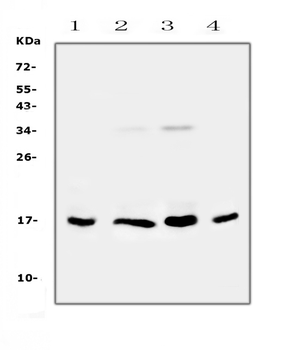 Anti-IL17B Antibody