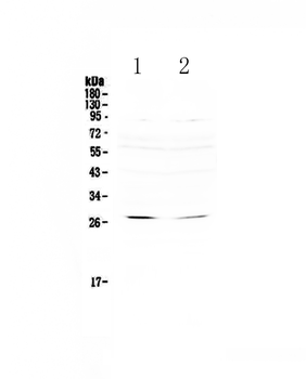 Anti-RNF186 Antibody