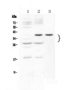 Anti-VEGF/Vegfa/VEGF164 Antibody