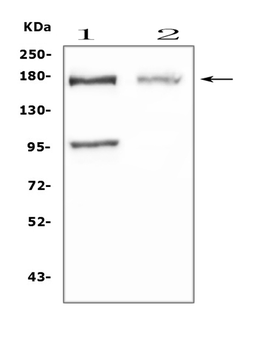 Anti-Niemann Pick C1/NPC1 Antibody