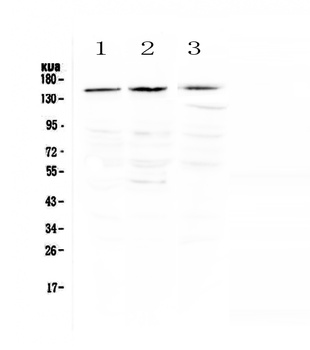 TrkA/NTRK1 Antibody