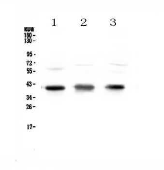 Anti-CCR4 Antibody