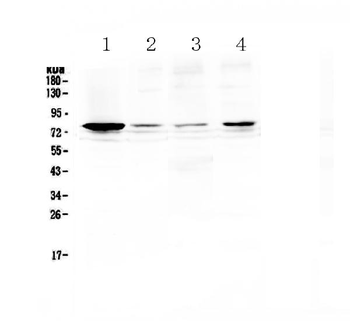Anti-RANK/TNFRSF11A Antibody