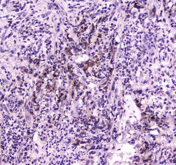 Anti-Niemann Pick C2/NPC2 Antibody