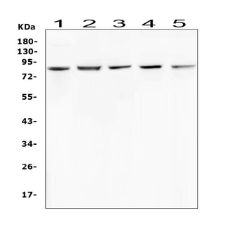 Anti-RNF43 Antibody