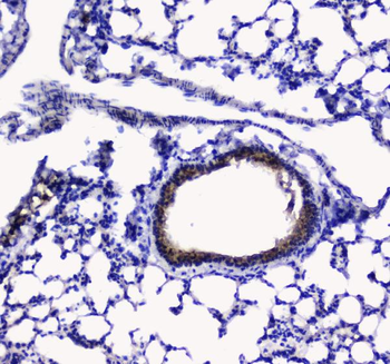 Anti-Betacellulin/Btc Antibody