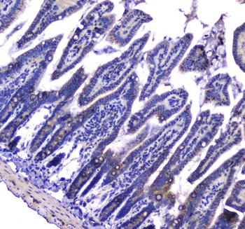 Anti-LGALS3BP Antibody