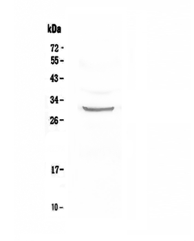 Anti-FRA1/FOSL1 Antibody
