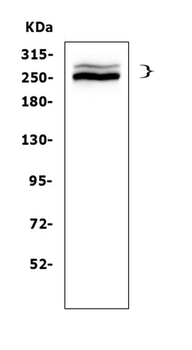 Anti-Desmoplakin/DSP Antibody
