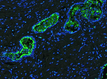 Anti-Lactoferrin/LTF Antibody
