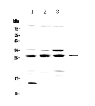 Anti-TPMT Antibody