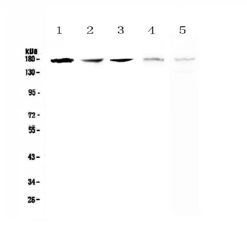 Anti-IRE1/ERN1 Antibody