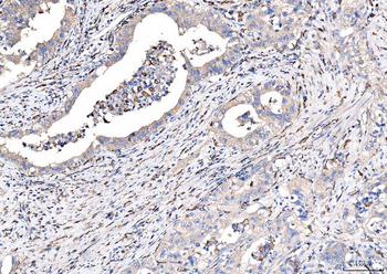 Anti-CD163 Antibody