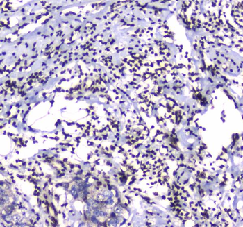Anti-GFI1 Antibody