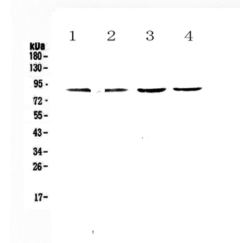 Anti-TBR2/Eomes Antibody