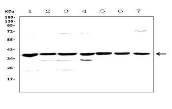 Anti-uPA Receptor/Plaur Antibody