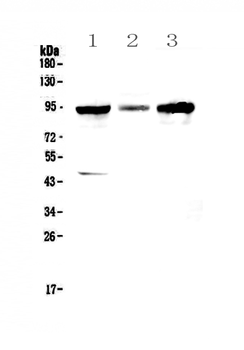 Anti-GNS Antibody