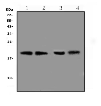 Anti-BCMA/Tnfrsf17 Antibody