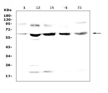 Steroid sulfatase/STS Antibody
