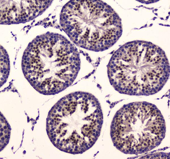 Anti-Mitochondrial Pyruvate dehydrogenase kinase 1/PDK1 Antibody
