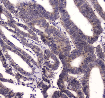 Anti-BRD7 Antibody