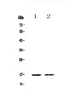 Anti-Galectin 10/CLC Antibody
