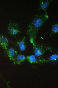 Anti-epithelial Sodium Channel alpha/SCNN1A Antibody