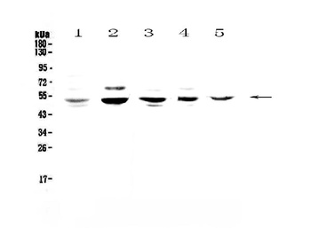 NFIB/NF1B2 Antibody