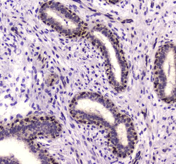 Anti-NFIB/NF1B2 Antibody