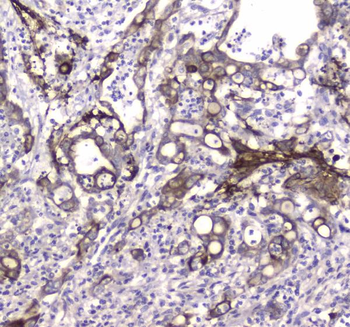 Anti-MAP1LC3A Antibody