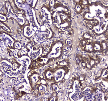 Anti-GDA Antibody