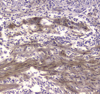 Anti-Creatine kinase B type/CKB Antibody
