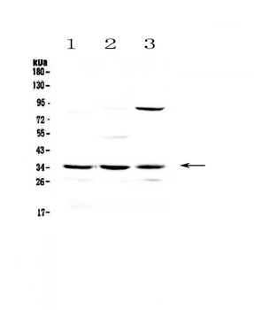 Bikunin/AMBP Antibody