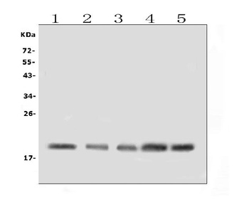 BAFF Receptor/TNFRSF13C Antibody