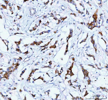 Anti-TACI/TNFRSF13B Antibody