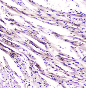 Anti-Cardiac FABP Fabp3 Antibody (monoclonal, 6C4)