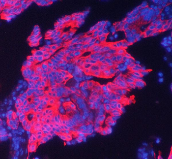 Anti-Cytokeratin 19 KRT19 Antibody (monoclonal, 3D4)