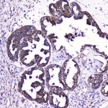 Anti-ATF4 Antibody